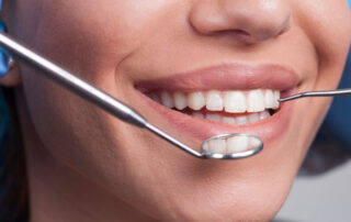 Wisdom Teeth Removal in Charleston