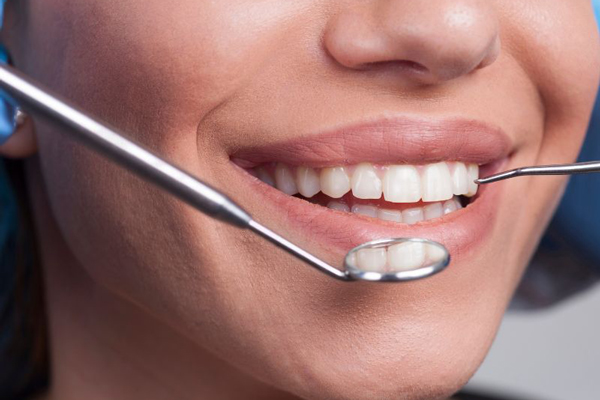 Wisdom Teeth Removal in Charleston